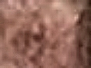 Pattern Recognition Nose Sample